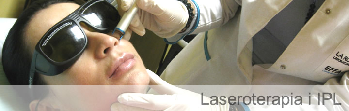 laseroterapia-IPL